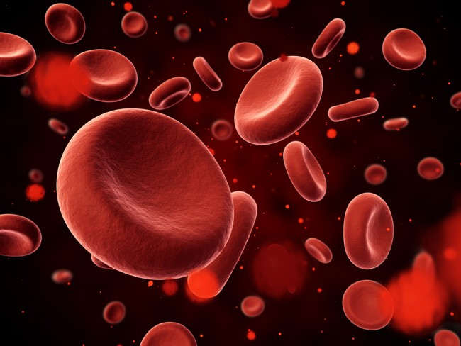 Lượng protein trong máu tăng cao là một trong những triệu chứng của bệnh thận hư nhiễm mỡ